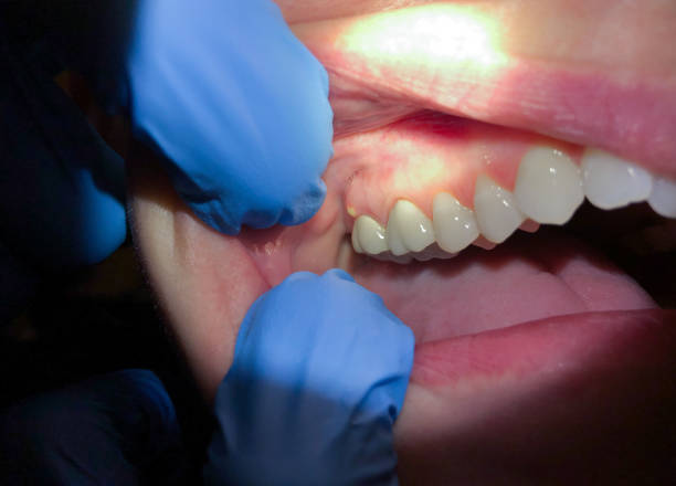 Best Emergency Dentist for Special Needs Patients in Nroe City, MO