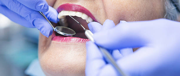Best Emergency Dentist for Lost Fillings or Crowns in Nroe City, MO